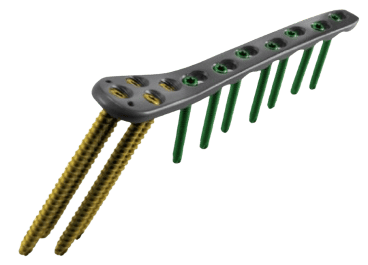 Placa para Fémur Proximal Lateral II