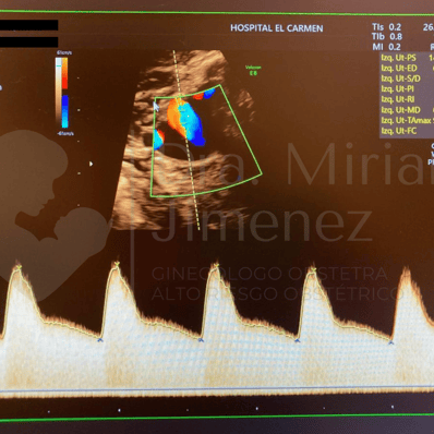 dra miriam jimenez ecografia