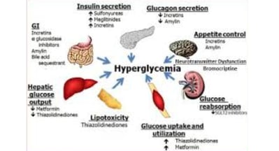 a diagram of the human body organs and hypoglcemia