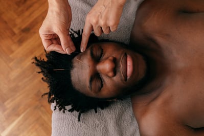 a man with black hair and darker skin is relaxing while receiving acupuncture 