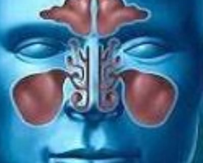 Effective Sinusitis Treatments Fasting & Honey