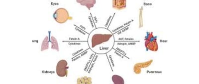 retinitis pigmentosa fasting