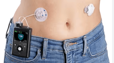 insulin pump therapy