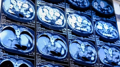 Sequência de imagens de uma tomografia de abdome usadas para fornecer um laudo diagnóstico