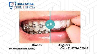 aligner & braces kolkata