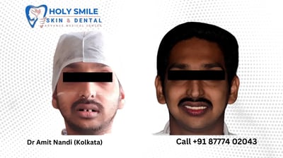 dental implant specialist kolkata Dr Amit Nandi