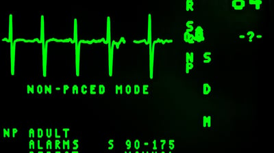 electrocardiograma en morelia