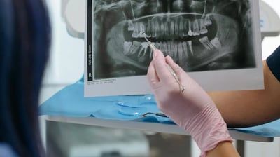 a dentist's hand holding a picture of a patient