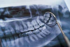 Imagem RX Dentista 24 Horas