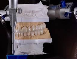 Modelos articulados e reabilitação Dentista 24 Horas