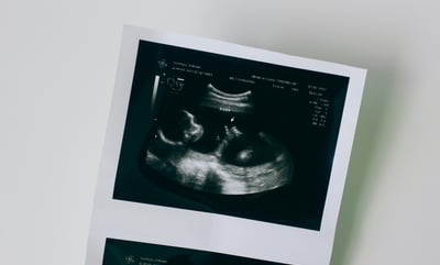 Fetal Development/Growth