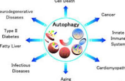 Explore how chronic illness and fasting affect sleep quality. Learn strategies to improve rest and m