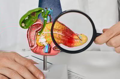 Pancreas Cancer treatment ahmedabad