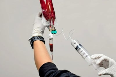 auto hemotherapy