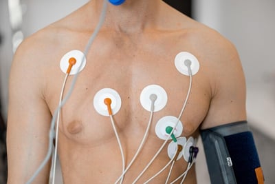 eletrocardiograma (ecg) e eletroencefalogra (eeg) e espirometria