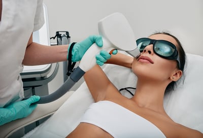 laser hair removal