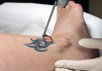 a person with a tattoo on their arm