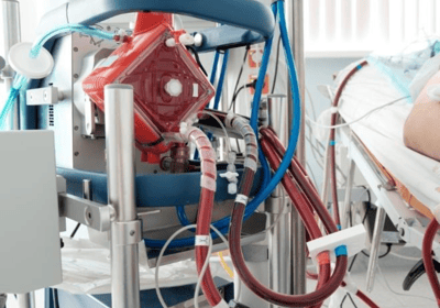 ECMO