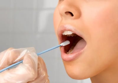 teste genético nutrição emagrecimento dieta