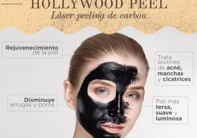 Hollywood Peel