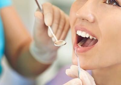 Dentist applying a tooth filling to restore a decayed tooth, showcasing a restorative dental procedu