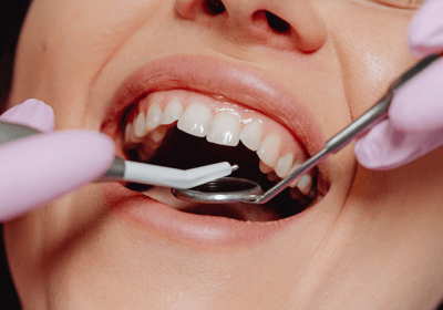 Dentist carefully extracting a damaged tooth using dental instruments in a clinical setting