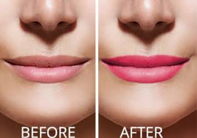 Skindent's Rejuvenate Lip Micropigmentation Services