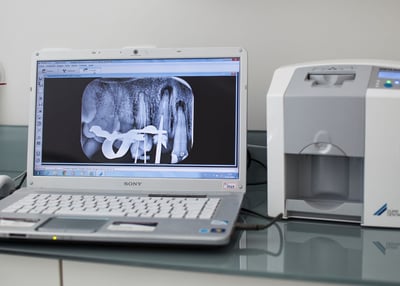 imagem de radiografia na tela do computador com scanner de radiografias ao lado
