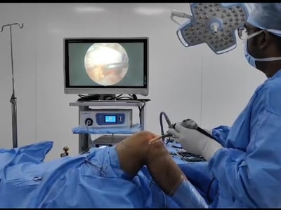 Surgeon performing minimally invasive arthroscopic surgery on a patient's knee.
