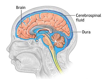 Brain. Dura and Cerebrospinal fluid