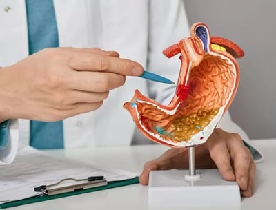 Exames de endoscopia e colonoscopia em Francisco Beltrão
