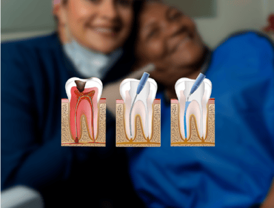 Endodoncia