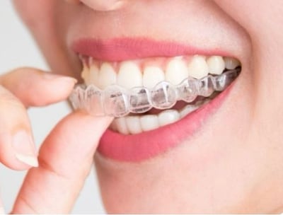 Orthodontics Invisalign Studio Piha