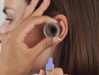 a woman having earwax removed with Microsuction