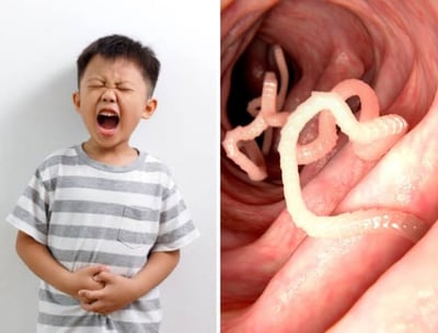 intestinal worms