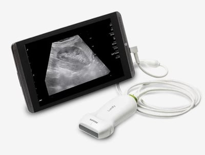 mobilne USG w domu, badanie usg płuc, usg brzucha