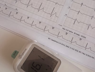 Estudio de la función eléctrica del corazón, es el principal estudio en el screening médico deportiv
