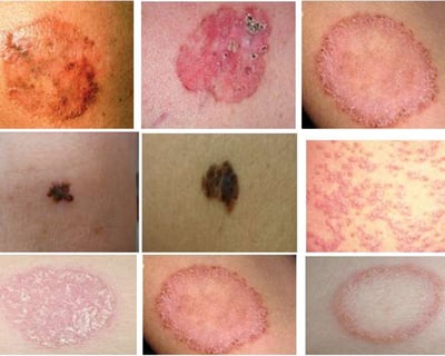 skin diseases treatment Unani clinic near Kalaburagi, Karnataka, Dr Hidayath khan