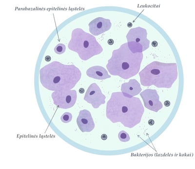 Aerobinio vaginito mikroskopija