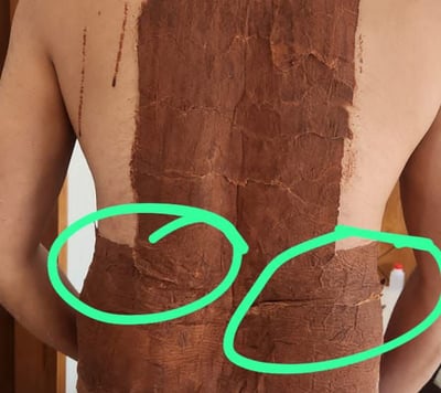Kerala Ayur Shakti Back Ache Treatment