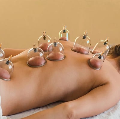 Cupping at Mowbray Marketplace