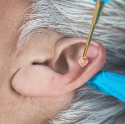 Réflexologie Auriculaire