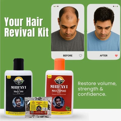 Shifayi Herbal hair products Alopecia Results