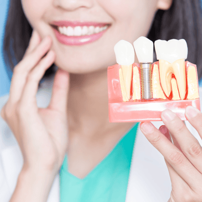 Affordable Dental Implants in Navi Mumbai | Ekdantam Dental Clinic kopar khairane