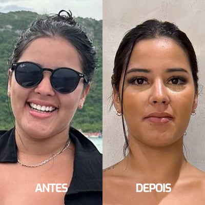 Fernanda Ara&uacute;jo - Antes e Depois