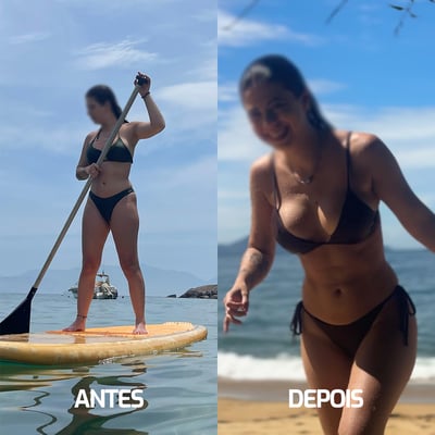 Marcelle Nunes - Antes e Depois