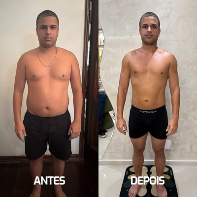 Thiago Lopes - Antes e Depois