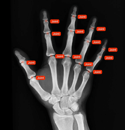 Healthcare Data Annotation with Quantify Data Solutions