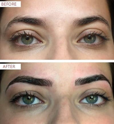 Skindent's Rejuvenate Eyebrows Microblading Services