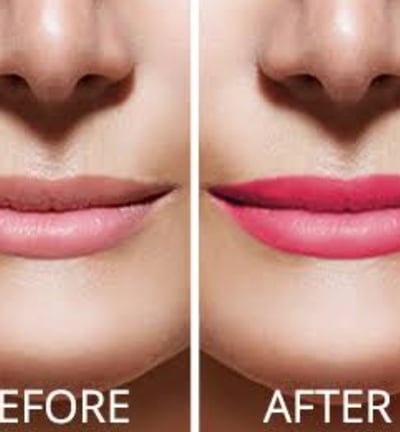 Skindent's Rejuvenate Lip Micropigmentation Services